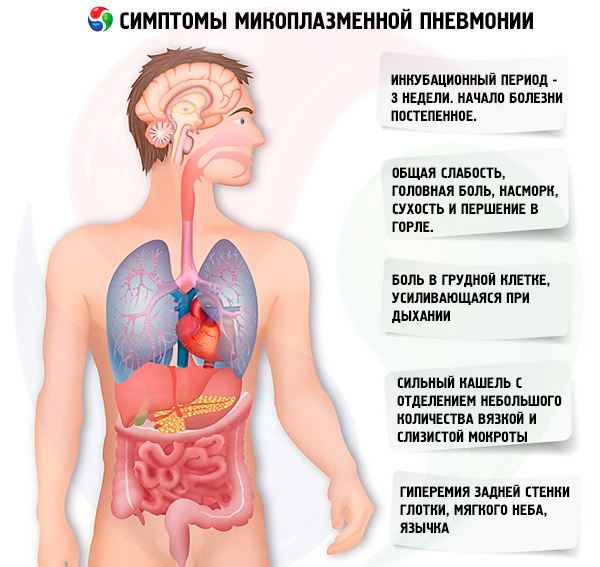 mikoplazmennaya pnevmoniya simptomy