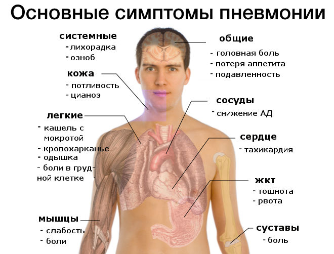 simptomy pnevmonii